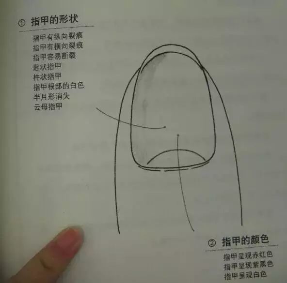 Essential Guide to TCM Observation Diagnosis: Easy to Understand (Recommended for Collection)