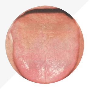 Understanding Tongue Diagnosis in TCM: Insights into Health from Tongue Appearance (Part 2)