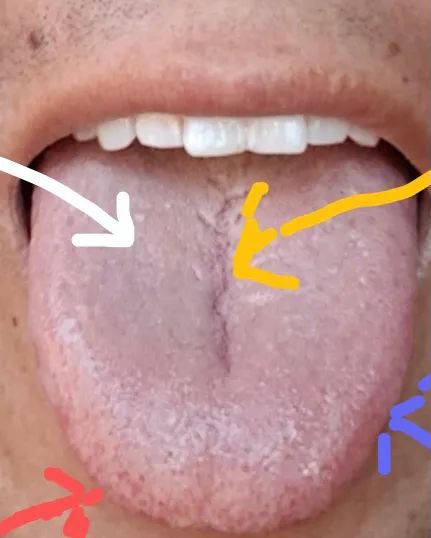 Tongue Diagnosis - Illustrated Guide to Tongue Manifestations