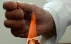 Experience Collection of Fire Needle Therapy