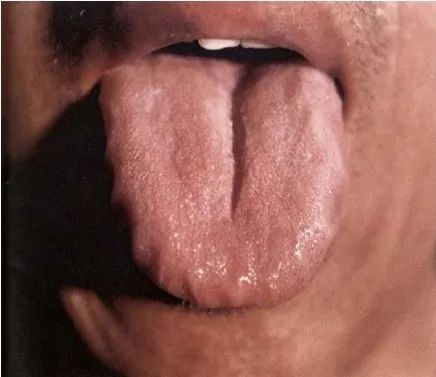 The Health Code Hidden on Your Tongue