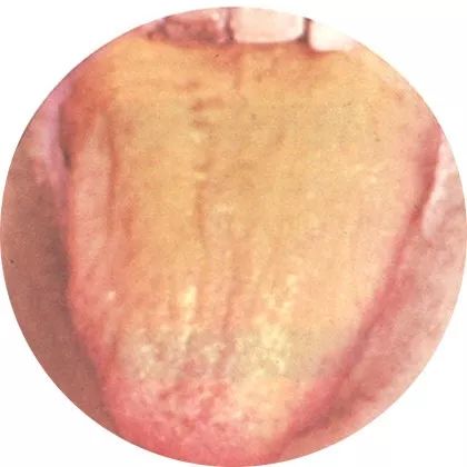 The Most Comprehensive High-Definition Real Tongue Diagnosis: Observing Tongue Patterns to Understand Internal Organs (Collection Edition)