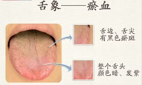 Comprehensive Guide to Tongue Diagnosis (Tongue Manifestations)