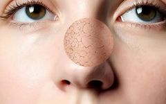 Can 'Deficiency' Also Cause Excess Heat? This Method is Essential for Those with This Constitution to Clear Heat, Nourish Yin, and Moisten Dryness!