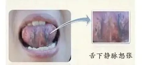 Inheritance of Traditional Chinese Medicine at Zhigu Tang | Basic Theory of TCM Lesson 34 (Tongue Diagnosis: Tongue Color)