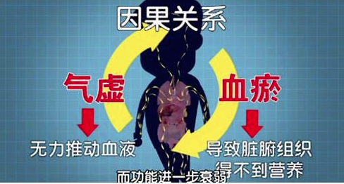 Understanding Blood Stasis Syndrome in Traditional Chinese Medicine