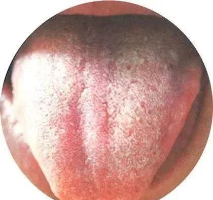 130 High-Definition Tongue Diagnosis Charts (Recommended for Collection)
