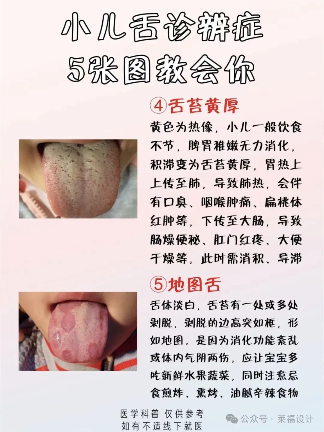 Analyzing Your Baby's Tongue Coating to Determine Spleen and Stomach Accumulated Heat