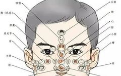 Traditional Chinese Medicine Diagnosis: Facial Observation