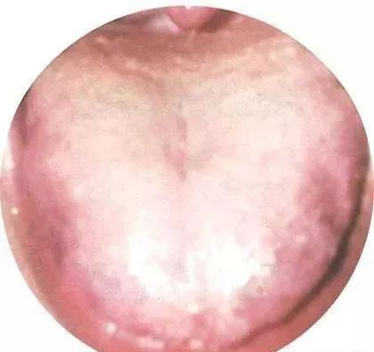 130 High-Definition Tongue Diagnosis Charts (Recommended for Collection)