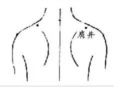 Ten Gua Sha Techniques to Relieve Various Ailments