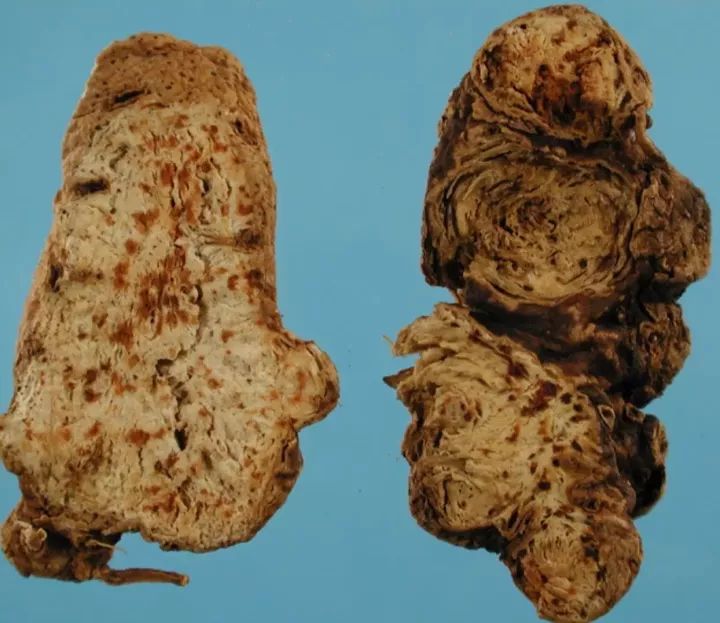 Learning About Traditional Chinese Medicine: Atractylodes (Cang Zhu)