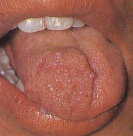 62 High-Definition Tongue Diagnosis Charts with Illustrations (Collector's Edition)