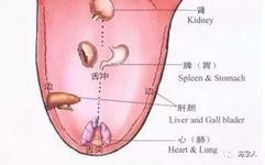 Comprehensive Guide to Tongue Diagnosis and Associated Conditions in TCM