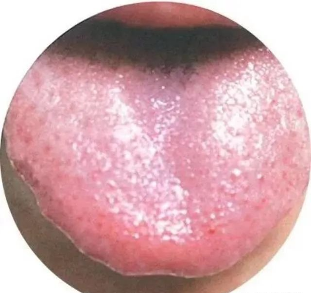 130 High-Definition Tongue Diagnosis Charts (Recommended for Collection)