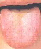 Comprehensive Guide to Tongue Diagnosis: Easily Understand Your Health Condition
