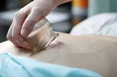What Do Cupping Marks Indicate After Treatment?