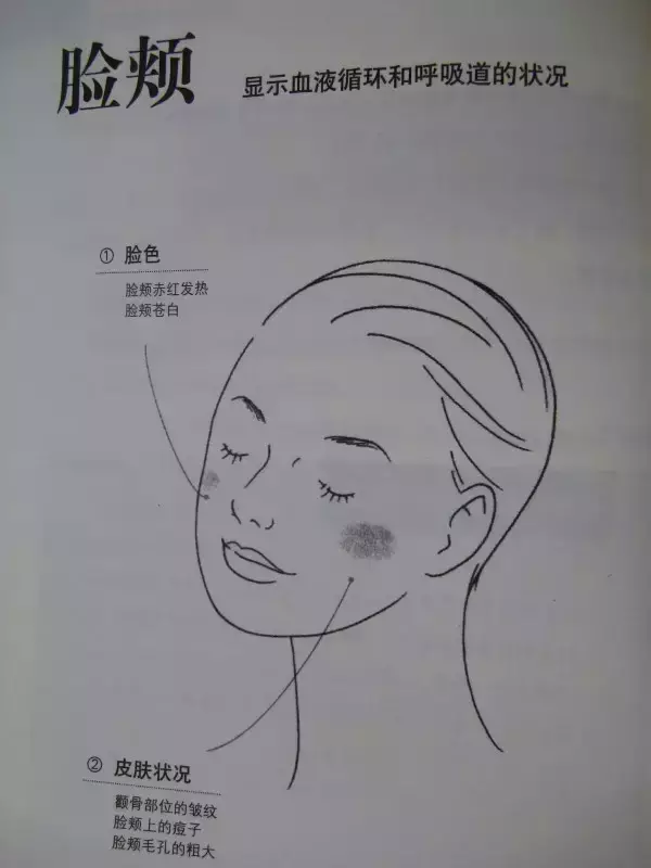 Essence of TCM Observation Diagnosis Illustrated