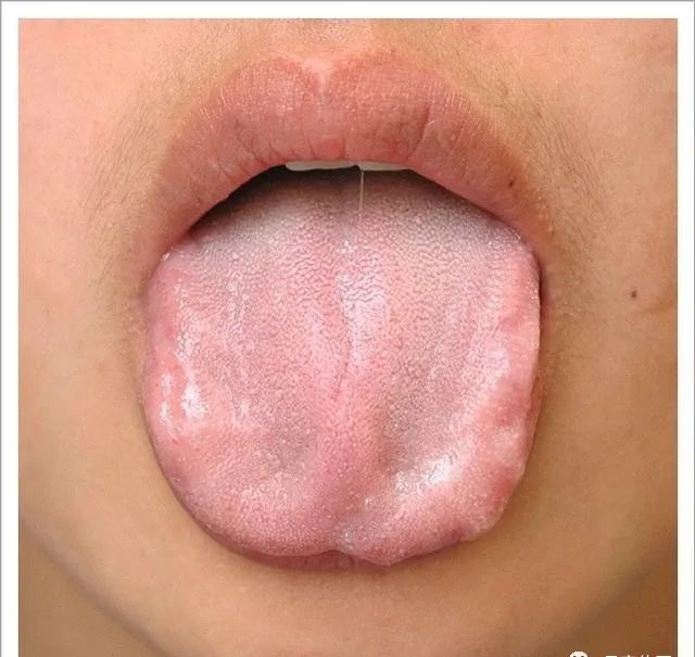 Traditional Chinese Medicine Tongue Diagnosis: 26 Clinical High-Definition Tongue Diagnosis Images with Analysis