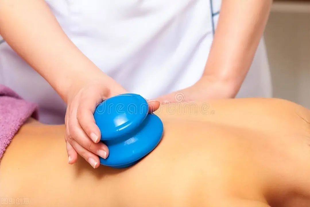 The Benefits of Cupping: Different Colors of Cupping Marks Reflect Various Health Conditions, Do You Know?