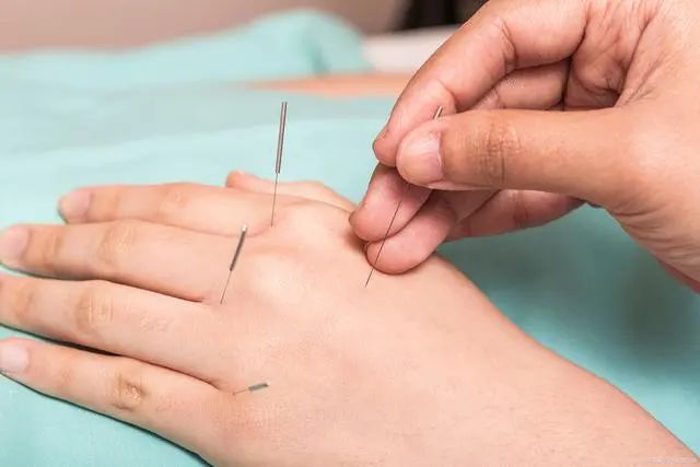 Bloodletting Therapy for 24 Difficult Diseases: A Unique TCM Approach
