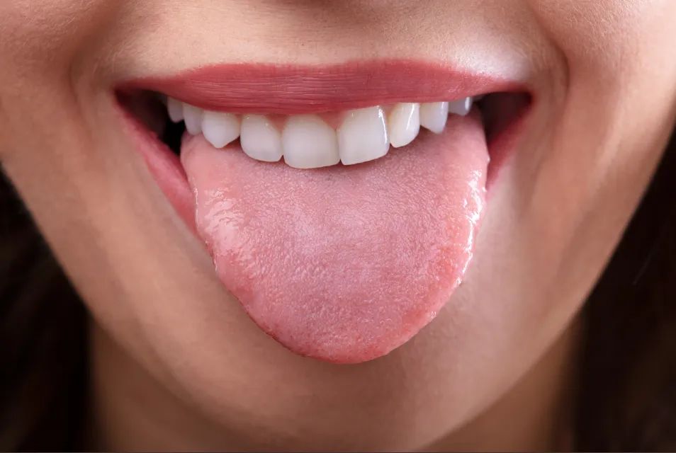 10 Types of Tongue Appearance That May Indicate Illness
