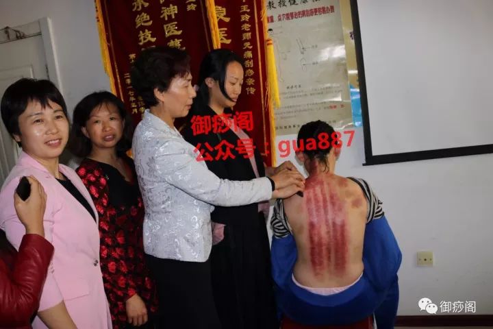Why Gua Sha Should Not Be Limited to the Back: The Wonders of Gua Sha