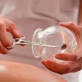 Incorrect Cupping Methods Can Harm Yourself!