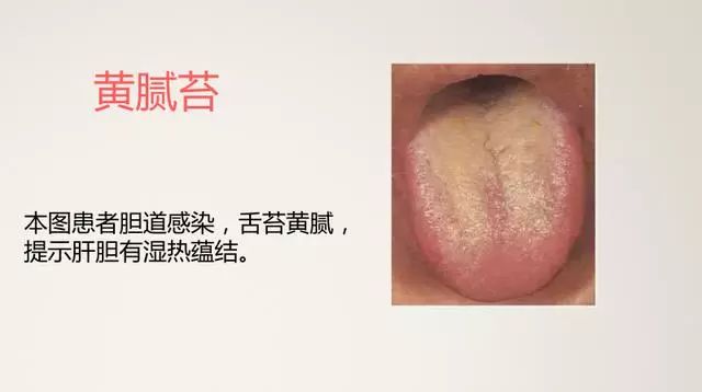 The Most Comprehensive TCM Tongue Diagnosis Atlas: Observe the Tongue, Understand the Whole Body!