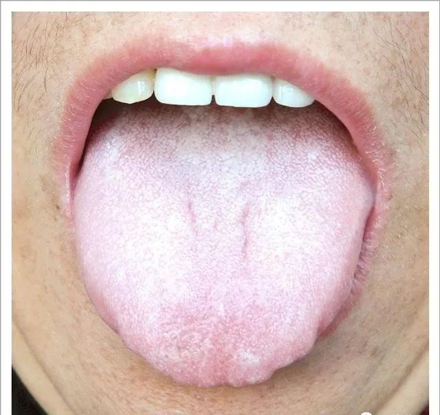 Traditional Chinese Medicine Tongue Diagnosis: 26 Clinical High-Definition Tongue Diagnosis Images with Analysis