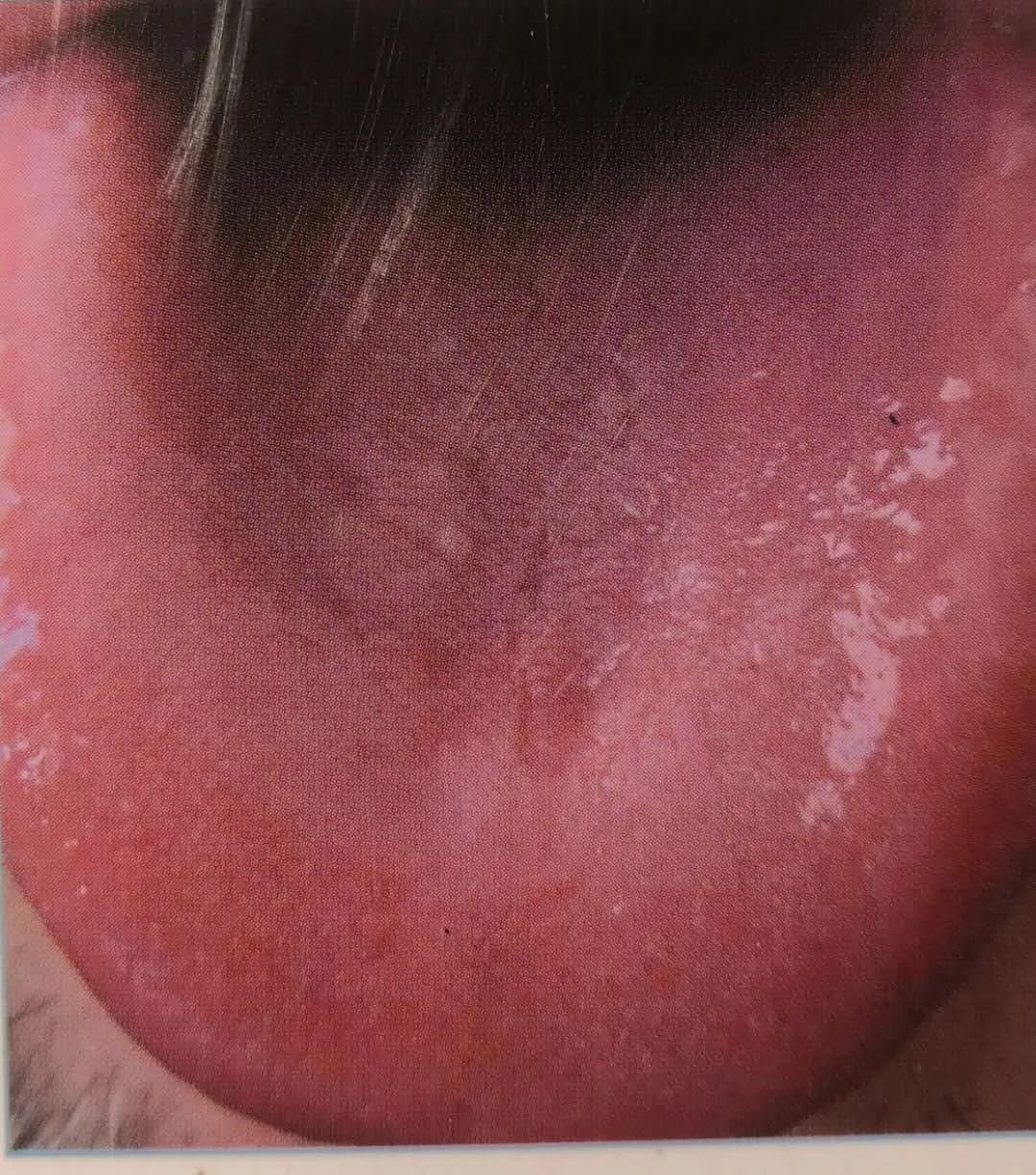 Inheritance of Traditional Chinese Medicine at Zhigu Tang | Basic Theory of TCM Lesson 34 (Tongue Diagnosis: Tongue Color)