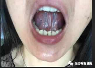 Understanding Your Tongue Diagnosis in 10 Minutes