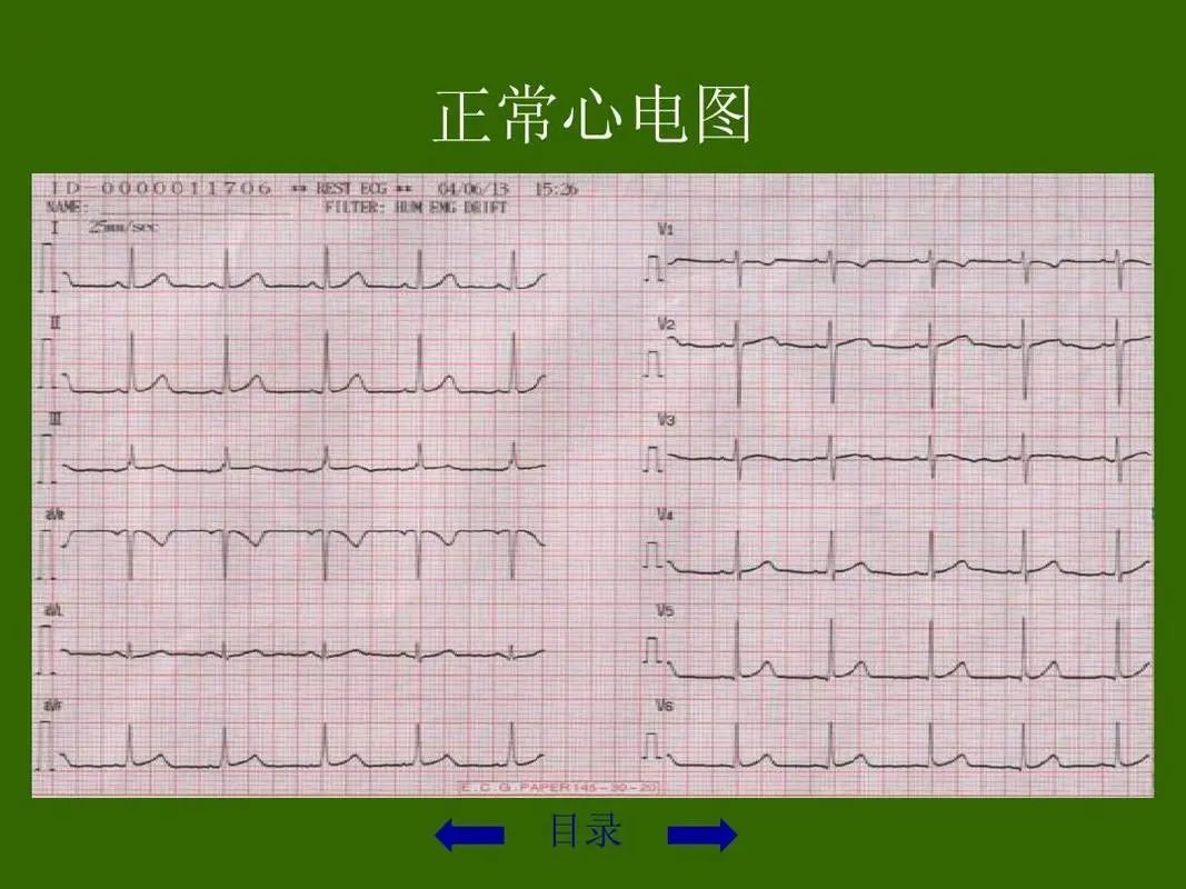 Understanding the Slippery Pulse in Traditional Chinese Medicine