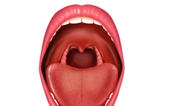 10 Types of Tongue Appearance That May Indicate Illness