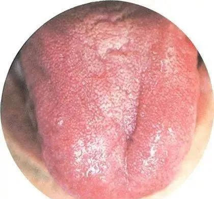 130 High-Definition Tongue Diagnosis Charts (Recommended for Collection)
