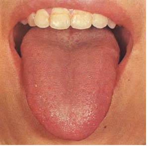 61 High-Definition Tongue Diagnosis Charts with Visual Comparisons