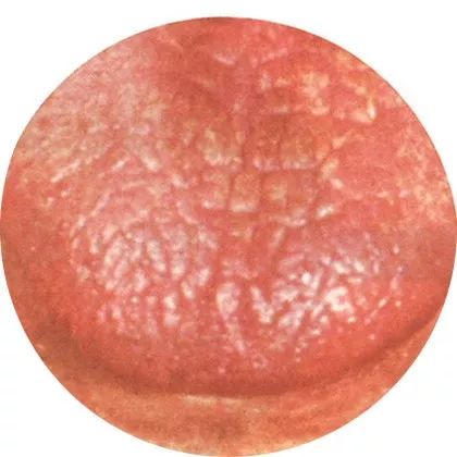 The Most Comprehensive High-Definition Real Tongue Diagnosis: Observing Tongue Patterns to Understand Internal Organs (Collection Edition)