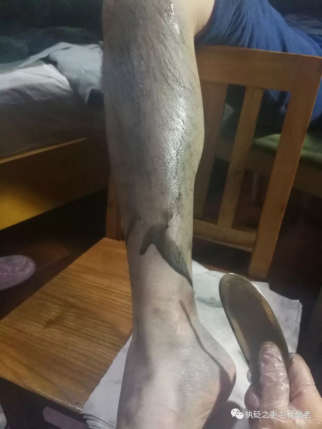 Black Sha: The Surprising Discovery of Copper Gua Sha