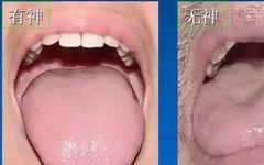 The Most Comprehensive Guide to Tongue Diagnosis! Master It and Become a Tongue Diagnosis Expert