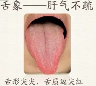 Comprehensive Guide to Tongue Diagnosis (Tongue Manifestations)
