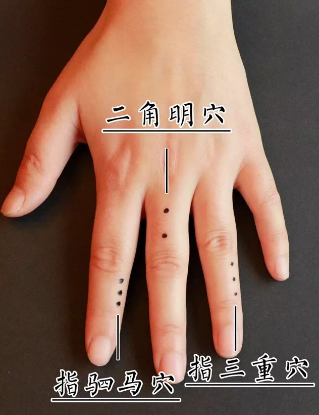 How Mr. Dong Jingchang Diagnoses Without Pulse Taking or Inquiry