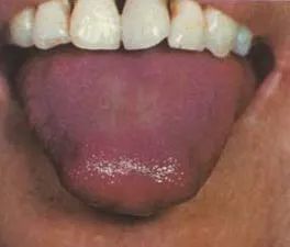 The Health Code Hidden on Your Tongue