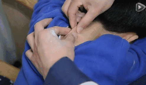 21 Pediatric Tuina Techniques to Easily Address Common Childhood Ailments!