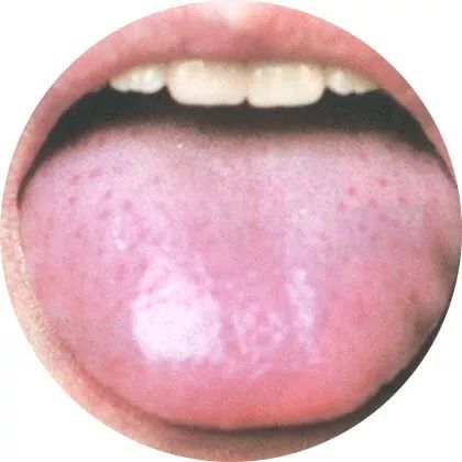 The Most Comprehensive High-Definition Real Tongue Diagnosis: Observing Tongue Patterns to Understand Internal Organs (Collection Edition)