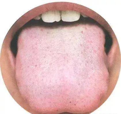 130 High-Definition Tongue Diagnosis Charts (Recommended for Collection)