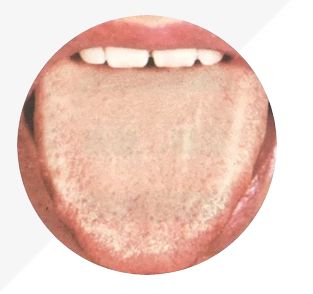 Understanding Tongue Diagnosis in TCM: Insights into Health from Tongue Appearance (Part 2)