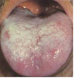 62 High-Definition Tongue Diagnosis Charts with Illustrations (Collector's Edition)