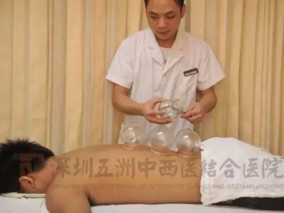 Ten Common Cupping Therapy Techniques