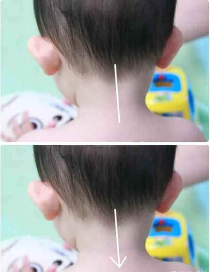 21 Pediatric Tuina Techniques to Easily Address Common Childhood Ailments!