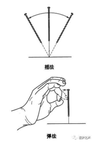 Acupuncture Techniques - Discussion on Needle Insertion Techniques (Part 2)